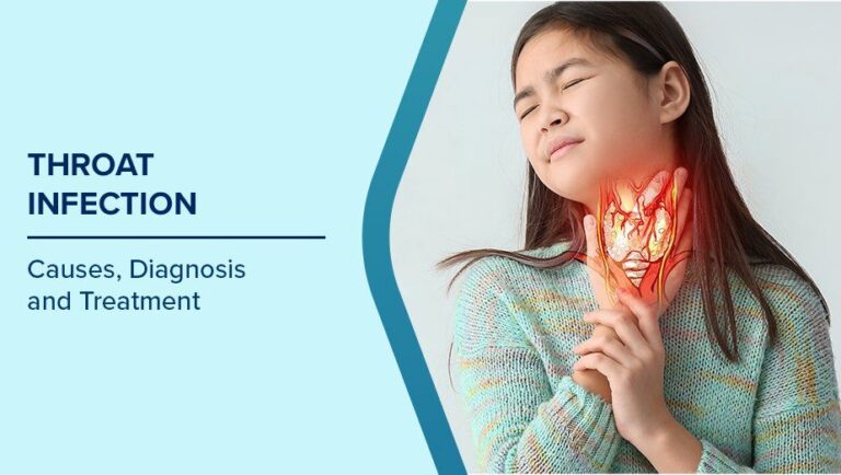 Throat_Infection_1_f650af1ffd