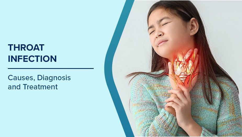 Throat_Infection_1_f650af1ffd